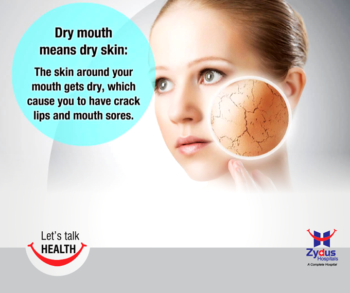 Take care of your #skin! 

#Healing #ZydusHospitals #Ahmedabad