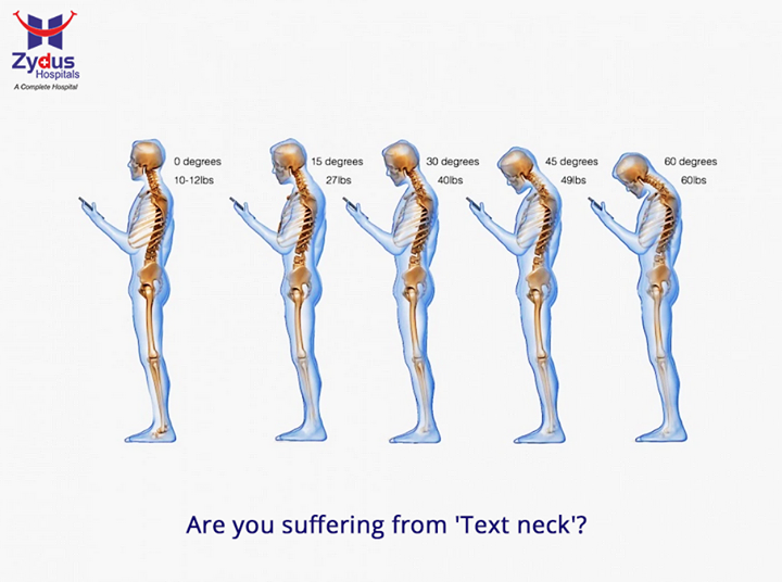 Are you suffering from 'Text neck'? If you spend hours texting or even staring at your smart phone, you put immense pressure on your spine which at can lead to early wear-and-tear, degeneration and even surgery. 

#TextNeck #HealthFacts #ZydusHospitals