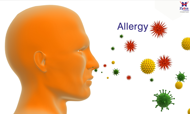 An allergy is a reaction by the immune system to something that does not bother most other people. People who have allergies often are sensitive to more than one thing. These diseases include hay fever, food allergies, atopic dermatitis, allergic asthma, etc.

#Allergy #Facts #ZydusHospital #Ahmedabad