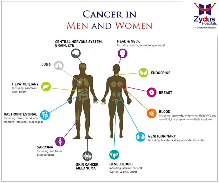 Cancer is the most unpredictable and complex of non-communicable diseases, accounting for 7% of Indian mortality, with numbers steadily rising. Here are some of the most estimated type of Cancers usually discovered in Men and Women

#Cancer #Facts #India #ZydusHospitals #Ahmedabad