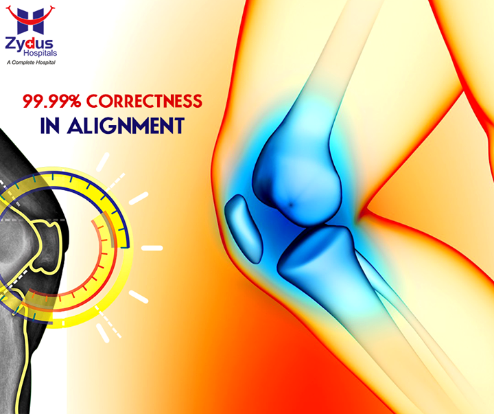 With a meticulous pre-operative analysis, “True Align Technique” ensures 99.99% correctness in alignment!

#TrueAlignTechnique #KneeReplacement #ZydusHospitals #Ahmedabad