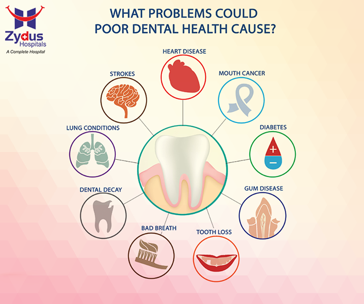 It's easy to ignore the effects of poor oral hygiene because they're hidden in your mouth. But gum disease may point to several health issues.

#HealthCare #ZydusHospitals #Ahmedabad