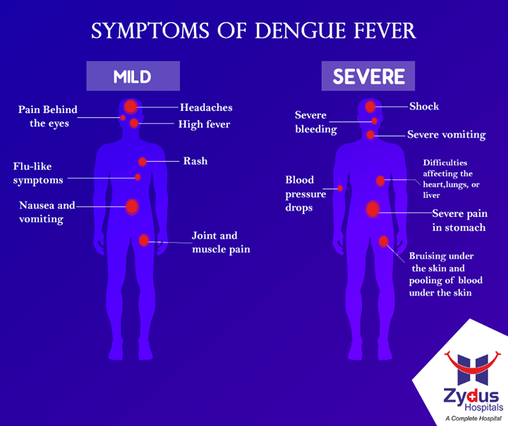 Do not ignore these symptoms of Dengue!

#DengueAttack #DengueFever #ZydusHospitals #Ahmedabad