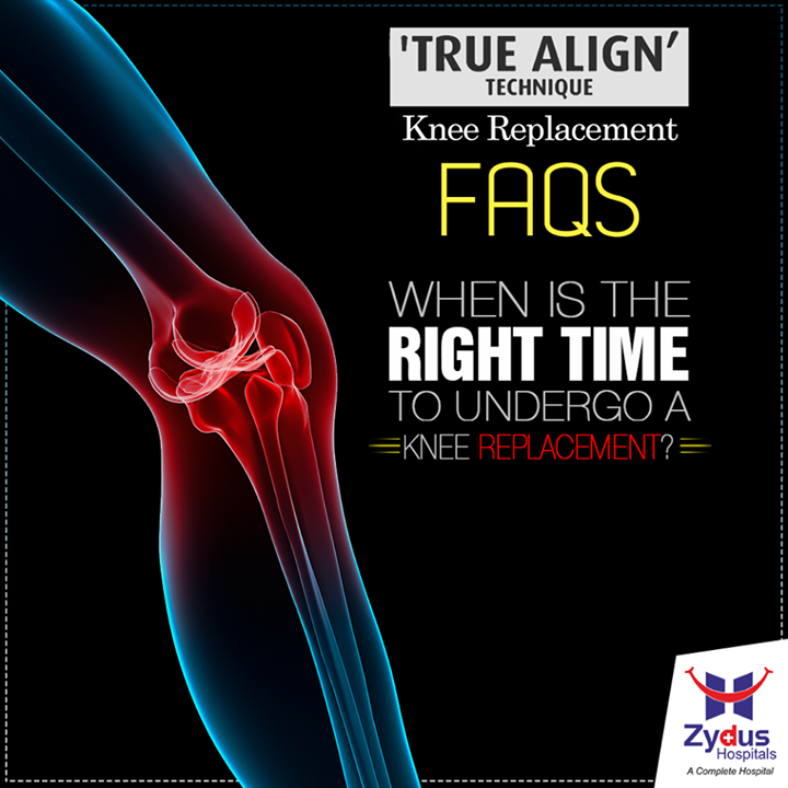 If you're having trouble getting up to answer the phone or walk to your car or your Knee Pain is affecting your day to day life style, it could be the right time to plan for a TKR. A thorough examination by a Joint Replacement expert should confirm if the time for TKR has arrived. If you are dependent on Pain Killers / NSAIDs on regular basis to keep yourself going, you should immediately consult the Joint Replacement expert.

To know more on Knee replacement visits our website: http://www.zydushospitals.com/joint-knee-replacement.html or call us on 1800 123 5433

#KneeReplacement #VisitUs #ZydusHospitals #Ahmedabad