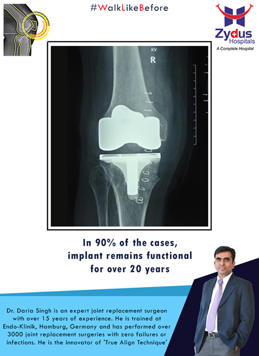 Implant remains functional for over 20 yrs!

For more info: http://truealignkneesurgery.com/
Our Chat Window - https://goo.gl/oSyuNK

#WalkLikeBefore #HipReplacements #ZydusHospitals #Ahmedabad #Gujarat
