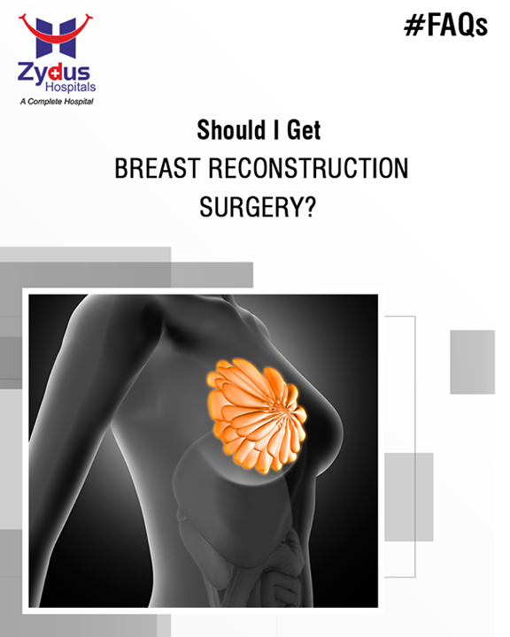 Women who have surgery to treat their breast cancer may choose breast reconstruction surgery to rebuild the shape and look of the breast.

#BreastReconstruction #ZydusHospitals #ZydusCare #StayHealthy #Ahmedabad
