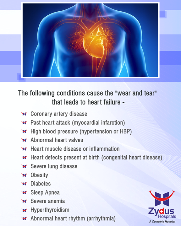Having more than one of these factors dramatically increases the risk of Heart Failure.

#Heartbeats #HeartCare #HealthyYou #ZydusHospitals #ZydusCare #StayHealthy #Ahmedabad