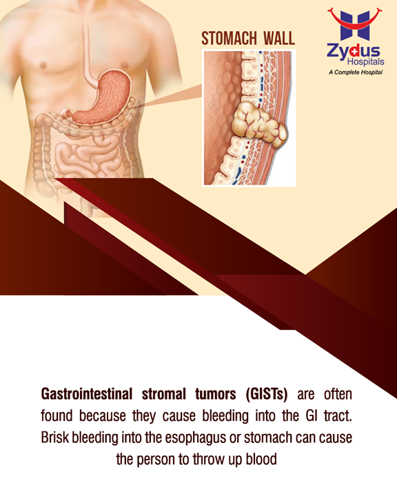 Gastrointestinal stromal tumors (GISTs) tend to be fragile tumors that can bleed easily

#Gastrointestinal #StromalTumors #HealthyYou #ZydusHospitals #ZydusCare #StayHealthy #Ahmedabad