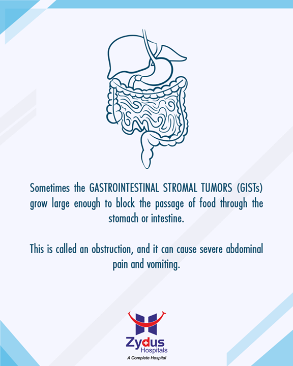 Emergency surgery might be needed in some cases of Gastrointestinal stromal tumors. Obstruction can be one of the reason.

#Gastrointestinal #StromalTumors #HealthyYou #ZydusHospitals #ZydusCare #StayHealthy #Ahmedabad