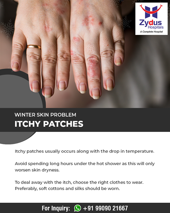 An easy way to tackle itchy skin patches is to avoid spending long hours under hot shower!

#ZydusHospitals #StayHealthy #Ahmedabad #GoodHealth #WinterHealth #SkinProblems