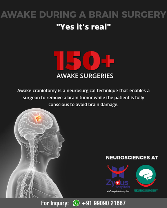 Awake craniotomy is a neurosurgical technique that enables a surgeon to remove a brain tumor while the patient is fully conscious to avoid brain damage.

#DidYouKnow #ZydusHospitals #Ahmedabad #GoodHealth #WeCare