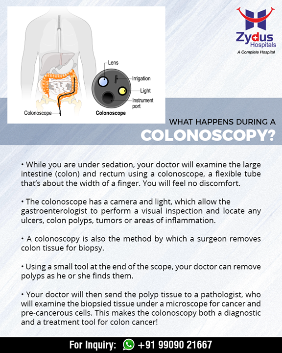 Exactly what happens while you undergo a #colonoscopy! 

#ZydusHospitals #StayHealthy #Ahmedabad #GoodHealth #ZydusCares #DidYouKnow
