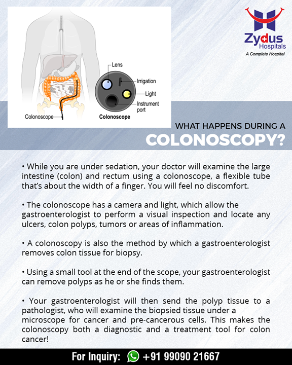 Exactly what happens while you undergo a #colonoscopy! 

#ZydusHospitals #StayHealthy #Ahmedabad #GoodHealth #ZydusCares #DidYouKnow