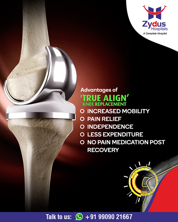Total knee replacement can increase mobility and decrease pain. It's the most rewarding surgery over last 2 decades. Predictable results - improved life - #tkr #totalkneereplacement

#kneereplacementsurgery #kneesurgery #kneereplacement #jointreplacement #truealignkneesurgery #StayHealthy #ZydusCare #ZydusHospitals #Ahmedabad #Gujarat