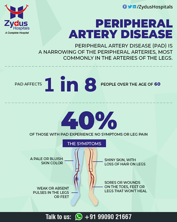 Peripheral artery disease (P.A.D.) is a disease in which plaque builds up in the arteries that carry blood to your head, organs, and limbs. 

#PeripheralArteryDisease #BloodVessels #ZydusHospitals #HealthCare #ZydusCare #Ahmedabad