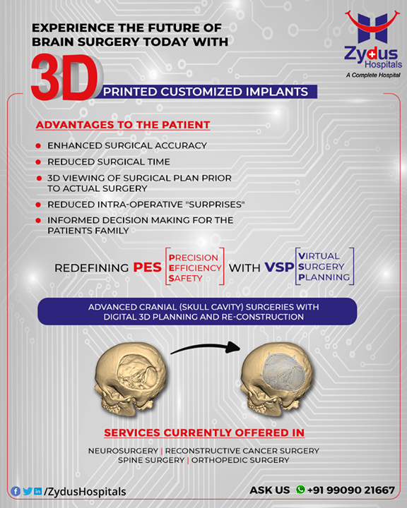 The Future of Brain Surgery is here! 

Zydus Hospitals is introducing 3D Printed Customized Implants which will redefine the current Brain Surgery Techniques with enhances surgical accuracy, reduced surgical time, incorporating Virtual Surgical Planning with Precision, Efficiency & Safety.

Want to know more Reach us on +91-9909021667 or leave a comment and we shall revert.

#BrainSurgery #Neurosurgery #Customized3DPrinted #BrainSurgeryTechniques #ZydusHospitals #Ahmedabad #SmileofGoodHealth