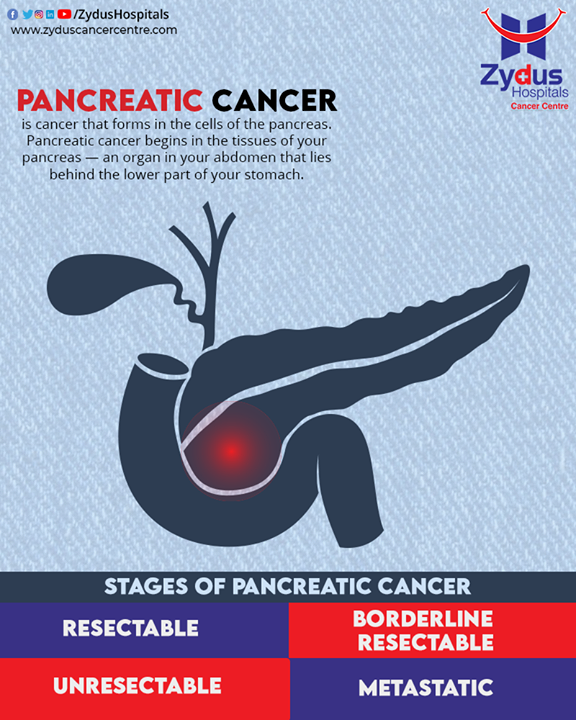The #pancreas secretes enzymes that aid digestion and #hormones that help regulate the metabolism of sugars. 

This type of cancer is often detected late, spreads rapidly and has a poor prognosis and hence it is important to treat it in early stages. 

#ZydusHospitals #ZydusCancerCentre #PancreaticCancer #MultiSpecialtyHospital #CancerTreatment #CancerHospital #AhmedabadHospital #GoodHealth