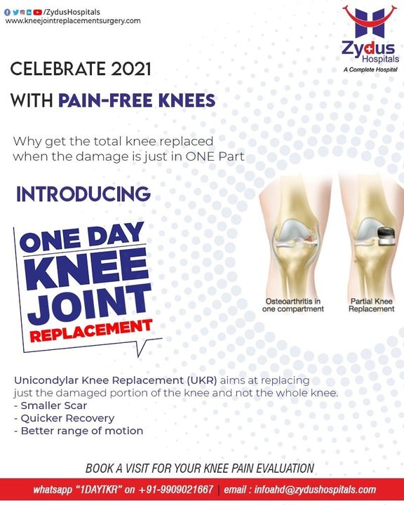 Also known as #partial knee replacement, a unicondylar #KneeReplacement is an alternative to total knee replacement for patients suffering from #osteoarthritis with damage confined to only one compartment of the #knee joint.
Get your knee checked by #Joint Replacement expert, before your next #move.

#ZydusHospitals #Healthcare #Bones #Orthopedics #JointReplacement #KneeSurgery #KneePain #OneDayTKR #Ahmedabad
