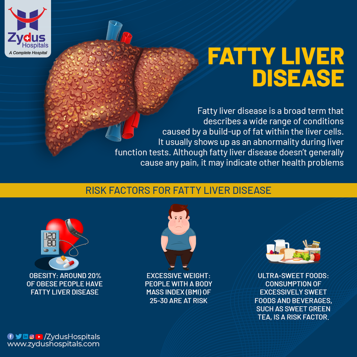 Fatty liver is also known as Hepatic Steatosis. It happens when there's increased build-up of fat in the liver and is caused mainly by being obese and diabetic. If not addressed, this condition may progress to more serious liver disease and other health problems.     
 
In case you experience abdominal pain, loss of appetite or extreme tiredness, please contact for appointment.                   
 
#FattyLiver #Liver #LiverDiseases #HepaticSteatosis #LiverCancer #Diabetes #Obesity #Exercise #EatHealthy #HealthyDiet #ZydusHospitals #HealthCare #StayHealthy #ZydusCare #Ahmedabad #Gujarat #BestHospitalinAhmedabad