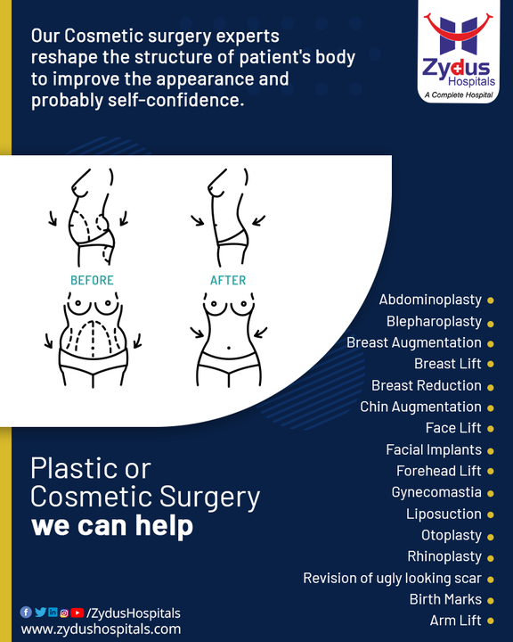 Cosmetic Surgery is a process of restoration, reconstruction, or alteration of the human body. It encompasses very precise & detailed procedures of aesthetically enhancing the appearance. These procedures are available for almost any part of the body, but the choice to undergo this surgery should be made with a lot of caution. 

Zydus Hospitals offer a wide range of cosmetic surgeries like Abdominoplasty, Breast Lift, Liposuction, Face Lift etc. With world class technology & our expert plastic surgeons, you don't need to second guess your decision.

#PlasticSurgery #CosmeticSurgery #Surgery #FaceLift #BreastLift #Implant #Liposuction #Hospital #Health #ZydusHospitals #HealthCare #StayHealthy #ZydusCare #Ahmedabad #Gujarat #BestHospitalinAhmedabad