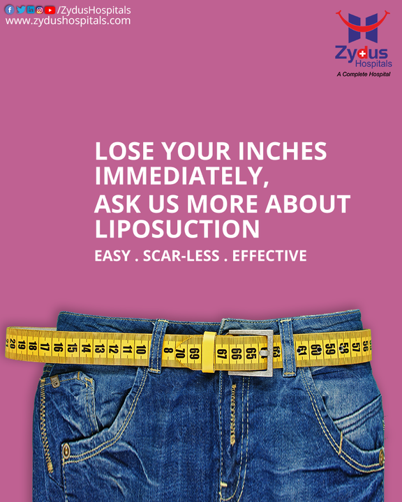 The procedure of Liposuction slims and reshapes the body by removing excess fat deposits and improving body contours on areas such as the abdomen, hips, thighs, buttocks, arms or neck. It reduces the number of fat cells and the skin molds itself to the new contours of the treated areas.

At Zydus Hospitals, Liposuction is Easy, Scar-Less & Effective with world class technology & our team of expert cosmetic surgeons.

#CosmeticSurgery #Surgery #Liposuction #FaceLift #BreastLift #BreastAugmentation #Abdominoplasty #Implant #Hospital #Health #ZydusHospitals #HealthCare #StayHealthy #ZydusCare #Ahmedabad #Gujarat #BestHospitalinAhmedabad