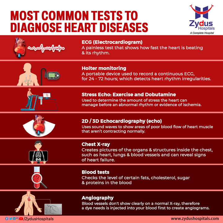 Not all pain from heart disease have the same signs and symptoms. The more we learn about heart disease, the more we realize that symptoms can be markedly different in different groups of people. Refer to these most common tests that are performed to diagnose heart-related problems and hence to understand the medical condition of a person.  

#ZydusHospitals #HeartDiseases #ECG #Holter #StressEcho #Echocardiology #XRay #Angiography #Heart #HeartFailure #Health #HealthCare #HealthyHeart #StayHealthy #ZydusCare #Ahmedabad #Gujarat #BestHospitalinAhmedabad