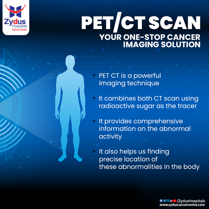 Get a more detailed picture of the organs and tissues inside your body and treat Cancer in the most precise way with PET/ CT Scan. This scan is a way to help find cancer and learn about the spread of it. It is hence necessary to perform these Imaging Tests primarily, to detect the affect of the disease on your body's functions. 

Zydus Cancer Centre offers world class Cancer Imaging Solutions, Contact us today. 

#PET #CTScan #Imaging #ImagingTechnique #CancerTest #CancerImaging #ZydusHospitals #ZydusCancerCentre #CancerCentre #CancerTherapy #CancerTreatment #Cancer #CancerousDiseases #BeatCancer #CancerAwareness #HealthCare #StayHealthy #ZydusCare #BestHospitalinAhmedabad #Ahmedabad #GoodHealth #CancerHospital