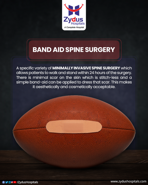 Have you heard of or read about Band Aid Spine Surgery?

It is called as the Band-Aid Spine Surgery because the incision can literally be covered with a band-aid.

Now that's priceless; isn't it? It is minimally invasive that leaves almost no scar behind and it offers the speediest recovery rate to the patient. 

Get in touch with the Spine experts at Zydus Hospitals to get further related and relevant queries.

#BandAidSurgery #BandAidSpineSurgery #MinimallyInvasive #SpineSurgery #SafeSpineSurgery #MinimalScar #SpeedyRecovery #ZydusHospitals #BestHospital #BestHospitalInAhmedabad #Gujarat