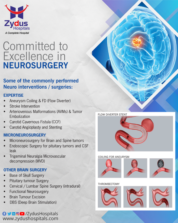 At Zydus Hospitals, we are the home to the best quality of neurosurgery services.

Neurological disabilities include a wide range of disorders and the list is quite long; but no-matter which disorder has crossed your path, being the epitome of excellence and innovation we will help you to fight strong. 

Successfully we have secured a prominent place in the neurosurgery field for which the credit goes to our advanced treatment and accurate diagnosis. With cutting-edge technology, patient-centric approach and higher standard of commitment, we are rendering the best possible neuro-surgery treatments to the patients with care and empathy.

Our team of neurosurgeons, neurologists and other associated specialists have extensive years of experience and we are available for your service round the clock.

#Neurosurgery #Neurology #NerveCells #BrainSurgery #MicroNeuroSurgery #ZydusHospitals #HealthCare #StayHealthy #ZydusCare #BestHospitalinAhmedabad #Ahmedabad #GoodHealth