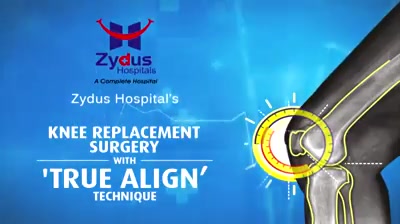 Here's Mrs. Shamim Dhalla sharing her experience on True Align Technique!

#Testimonial #TrueAlignTechnique  #ZydusHospitals #ZydusCare #StayHealthy #Ahmedabad
