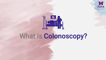 #ColonCancer #DetectItNow 

#Colonoscopy is an exam which is used to detect abnormalities or changes in the large intestine (colon) and rectum. A long, flexible tube (colonoscope) is inserted into the rectum & a video camera at the tip of the tube allows the doctor to view the inside of the entire colon. If necessary, tissue samples (biopsies) can be taken during a colonoscopy as well.

#Cancer #ZydusHospitals #ZydusCancerCentre #MultiSpecialtyHospital #CancerTreatment #CancerHospital #Oncology #AhmedabadHospital #BestHospitalInAhmedabad #CompleteHospital