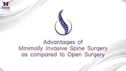 Minimally invasive spine surgery is an alternative to traditional open surgical procedures performed to treat different spinal disorders. This type of surgery uses smaller incisions than standard surgery and often causes less harm to nearby muscles and other tissues. The most advantageous aspect is that it can lead to less pain and faster recovery after the surgery.

#ZydusHospitals #Spine #SpineSurgery #Surgeries #MinimallyInvasiveSurgery #SpinalDisorders #SpineDiseases #FasterRecovery #HealthCare #StayHealthy #ZydusCare #Ahmedabad #Gujarat #BestHospitalinAhmedabad