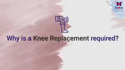 Knee replacement, is a surgical procedure to replace the weight-bearing surfaces of the knee joint to relieve pain and disability. It may be time to have a knee replacement surgery if you have severe knee pain that limits your everyday activities or  knee inflammation and swelling that doesn't get better with medications.

We are here to assist you, Call or WhatsApp on: +919909021667

#ZydusHospitals #Healthcare #Bones #Orthopedics #JointReplacement #KneeSurgery #KneePain #TKR #TotalKneeReplacement #OneDayTKR #Ahmedabad