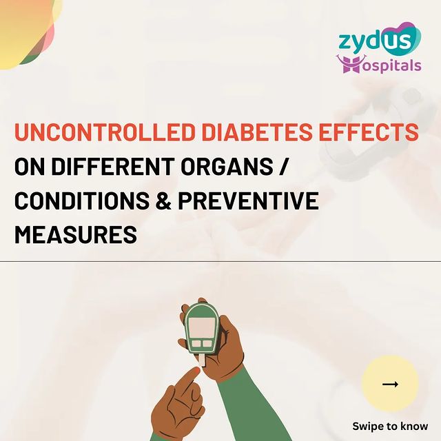 Uncontrolled diabetes can have severe effects on various organs including the eyes, heart, brain, kidneys, the nervous system, and the reproductive system.

Please keep the preventive measures in mind to avoid unnecessary complications. Early detection and treatment of any complications can also help prevent further damage and improve outcomes in the future.

To consult with our team of experts at the Zydus Diabetes Clinic, contact: 079 6619 0300

#Diabetes #DiabetesMellitus #DiabetesManagement #DiabetesControl #UncontrolledDiabetes #Effects #Symptoms #PreventiveMeasures #DiabetesAwareness #DiabetesCare #HealthCheck #HealthyLifestyle #DiabetesClinic #ZydusExperts #Healthcare #ZydusHospitals #BestHospitalsInAhmedabad #Ahmedabad #Gujarat
