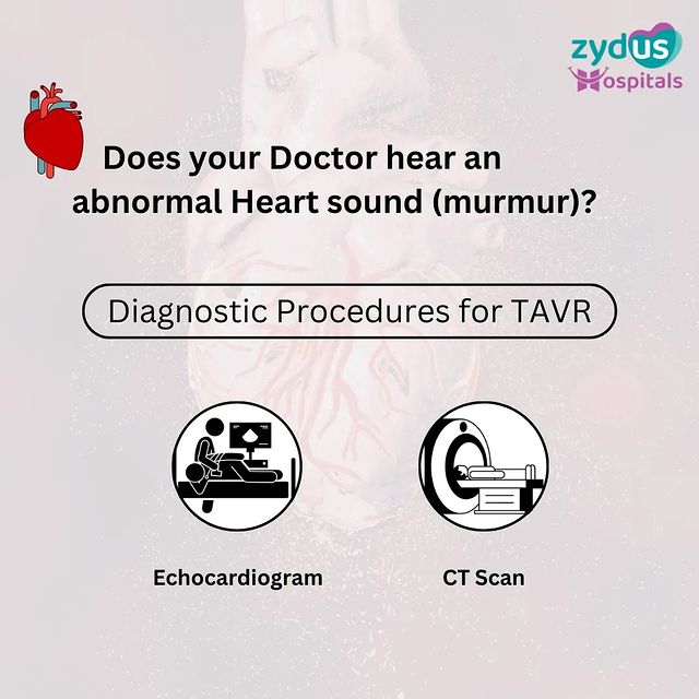 A disorder of the Heart valve usually leads to an abnormal heart sound (murmur); when this happens, understand which tests your doctor would suggest before they perform TAVR (Transcatheter Aortic Valve Replacement).

#TAVR #TAVI #TranscatheterAorticValveReplacement #AorticStenosis #TAVRAdvantages #TAVRBenefits #CardiovascularCare #Cardiology #CardiacSurgery #ZydusHospitals #ZydusCare #ZydusSpecialists #BestHospitalinAhmedabad #Gujarat