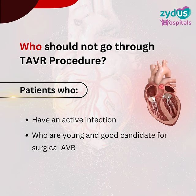 Learn about who could not benefit from TAVR (Transcatheter Aortic Valve Replacement).

#TAVR #TAVI #TranscatheterAorticValveReplacement #AorticStenosis #TAVRAdvantages #TAVRBenefits #CardiovascularCare #Cardiology #CardiacSurgery #ZydusHospitals #ZydusCare #ZydusSpecialists #BestHospitalinAhmedabad #Gujarat