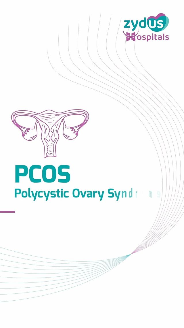 PCOS (Polycystic Ovarian Syndrome) affects 20–30% of Indian females, but what exactly is it? What are the signs and symptoms?
Listen to Dr. Riddhi Shah, an obstetrician and gynecologist at Zydus Hospitals, share some valuable insights about PCOS, how a gynecologist diagnoses it, and how the treatment varies based on a woman's stage of life.

#PCOSAwareness #PolycysticOvarianSyndrome #WomensHealth #GynecologyInsights #HealthcareExpertise #ZydusHospitals #GynecologistAdvice #HealthEducation #FemaleHealth #HormonalImbalance #PCOSSignsAndSymptoms #GynecologyDiagnosis #WomenWellness #ZydusGynecology #LeadingMedicalCare #HealthcareExcellence #MedicalExpertise #ZydusHealthcare #HealthTalk #GynecologyCare #HealthcareSupport #ZydusPride
