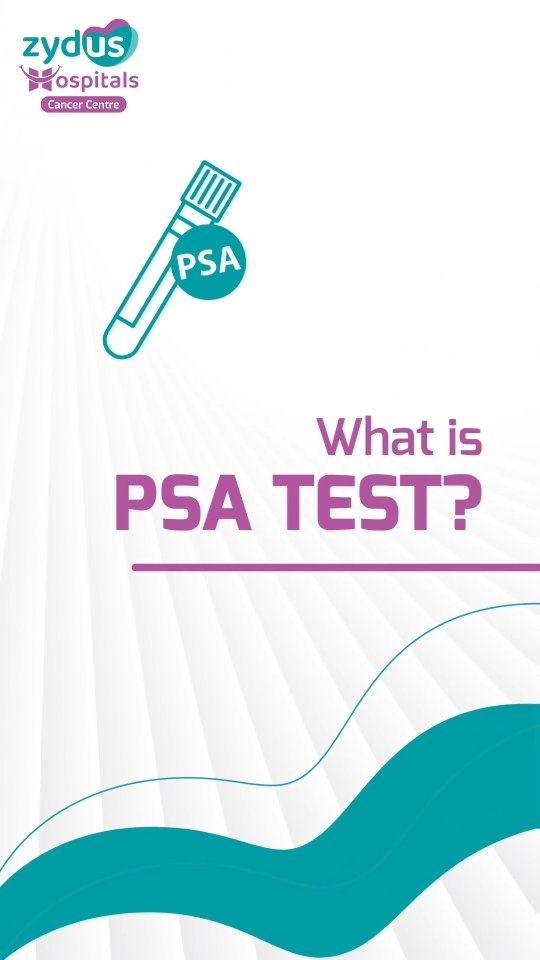 Did you know that a straightforward blood test can swiftly identify the second most common cancer in men? Indeed, the PSA test is capable of detecting prostate cancer in its early stages, offering better chances of recovery.

Discover additional information about the PSA Test by watching this video.

#ProstateCancer #PSATest #EarlyDetection #MensHealth #CancerScreening #ZydusHospitals #CancerAwareness #MedicalTests #HealthCheckup #CancerPrevention #PSA #HealthcareForMen #CancerScreening #ZydusCare #MensHealthMatters