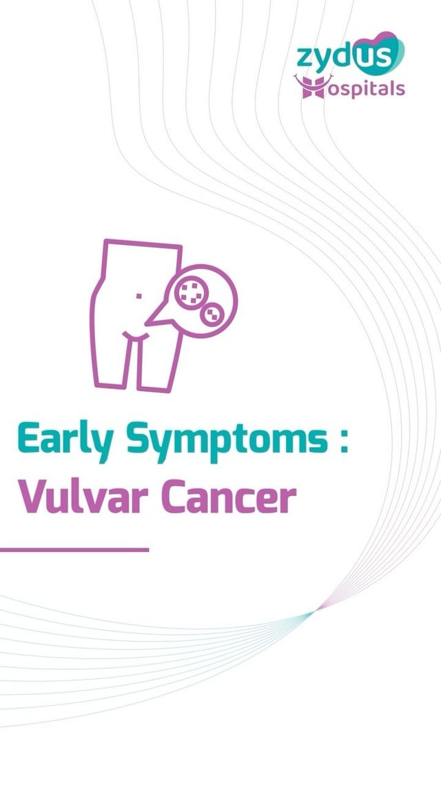 Dr. Ava Desai, Senior Gynecological Oncosurgeon at Zydus Hospitals, discusses Vulvar Cancer, its symptoms, and the importance of consulting a Gynecological Oncosurgeon when experiencing certain symptoms. She underscores the significance of seeking treatment from specialized cancer centers equipped with advanced technology.

#VulvarCancerAwareness #GynecologicalHealth #CancerSymptoms #GynecologicalOncology #CancerTreatment #WomenHealthMatters #EarlyDiagnosis #MedicalSpecialists #CancerCare #ZydusHospitals #AdvancedTechnology #SpecializedCare #CancerSupport #HealthAwareness #LinkedInTrending #ZydusExpertise #MedicalInnovation #CancerPrevention #HealthEducation #GynecologicalOncosurgery #ExpertMedicalOpinion #CancerAwarenessMonth #ZydusWellness #CancerResearch #FemaleHealth #VulvarCancerSurvivor