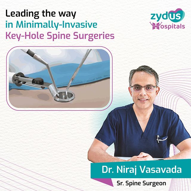 Once a highly active woman, now at the age of 55, she endured seven long years fighting the relentless grip of severe back pain and the rapid effects of accelerated aging-related changes on her spine. This struggle forced her into a stooped posture due to the bending of her spine at a relatively young age. While she sought the expertise of Dr. Niraj Vasavada, Sr. Spine Surgeon at Zydus Hospitals, he advised something unconventional. In more severe cases like hers, traditional corrective spine surgeries involve long, deep incisions, often up to 10 inches in length, significant blood loss of 800-900 ml, extensive muscle dissection, and a heightened risk of infection. However, Dr. Niraj presented her with a minimally invasive keyhole approach that she eventually opted for as it promised to mitigate many of the drawbacks associated with conventional surgeries. The surgical team skillfully made four to five small half-inch incisions and artfully realigned her deformed spine through these small openings. They also made a small abdominal incision to carefully remove the damaged disc and replace it with a new disc and a spacer, restoring her spine’s alignment. Remarkably, within 24 hours post-surgery, she could stand upright with her stoop corrected. Although this key-hole approach carried certain challenges such as the risk of damaging major vessels, however, Dr. Niraj’s extensive experience of successfully performing numerous such surgeries since 2015 proved invaluable. He is one of the very few surgeons in Western India who performs such multi-level minimally invasive surgeries with ease.
Within weeks, she seamlessly resumed her daily activities, now pain-free. Little did she realize that this decision would relieve her long-term suffering and completely transform her life. 
#SpineHealth #MinimallyInvasiveSurgery #OrthopedicCare #BackPainRelief #SpineRecovery #HealthcareTransformation #ZydusHospitals #AdvancedMedicine #ScoliosisRecovery #OrthopedicInnovation #LifeChangingSurgery #PainFreeLife #InnovativeTreatment