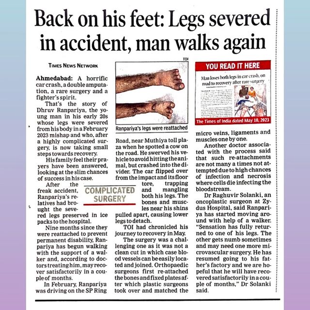 Walking against all odds.

Dhruv Ramapriya's story exemplifies how perseverance and comprehensive care can make a difference in someone's life. From the severed legs to now taking small steps towards recovery, this story emphasizes the exceptional efforts of Dr. Raghuvir Solanki, Plastic & Onco-Reconstructive Surgeon; Dr. Jatin Bhojani, Plastic & Onco-Reconstructive Surgeon; Dr. Shailendra, Plastic Surgeon; Department of Anesthesia, Critical care, Orthopaedics and the entire team of Physiotherapy at Zydus Hospitals.

#RecoveryJourney #Perseverance #ComprehensiveCare #ZydusHospitals #MedicalMiracle #SurvivorStory #AmputeeRecovery #Teamwork #MedicalHeroes #OrthopedicSurgery #PlasticSurgery #Physiotherapy #AmputeeSuccess #PersonalGrowth #LifeAfterAmputation #ZydusCares
