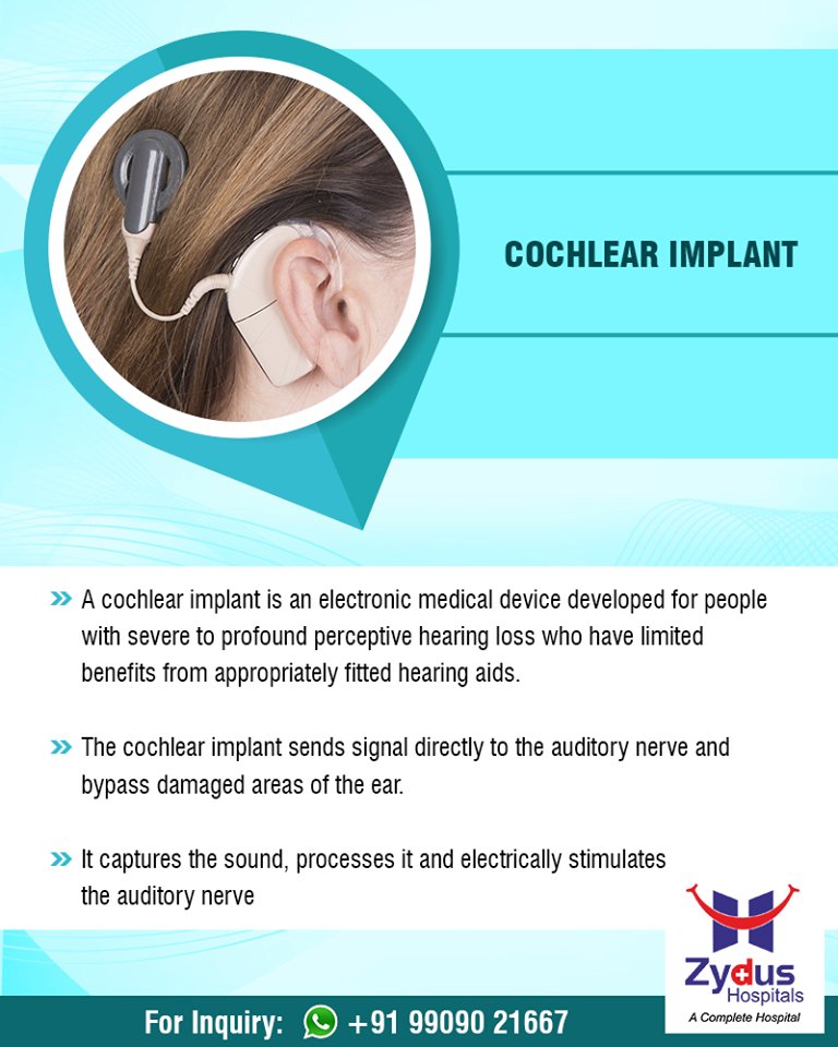 Cochlear implantation is a safe and proven procedure that every day helps to improve hearing and the quality of life for over 3,00,000 people around the world. 
#Cochlear #Implant #ENT #ZydusHospitals #StayHealthy #Ahmedabad #GoodHealth https://t.co/jjhubjbdbP