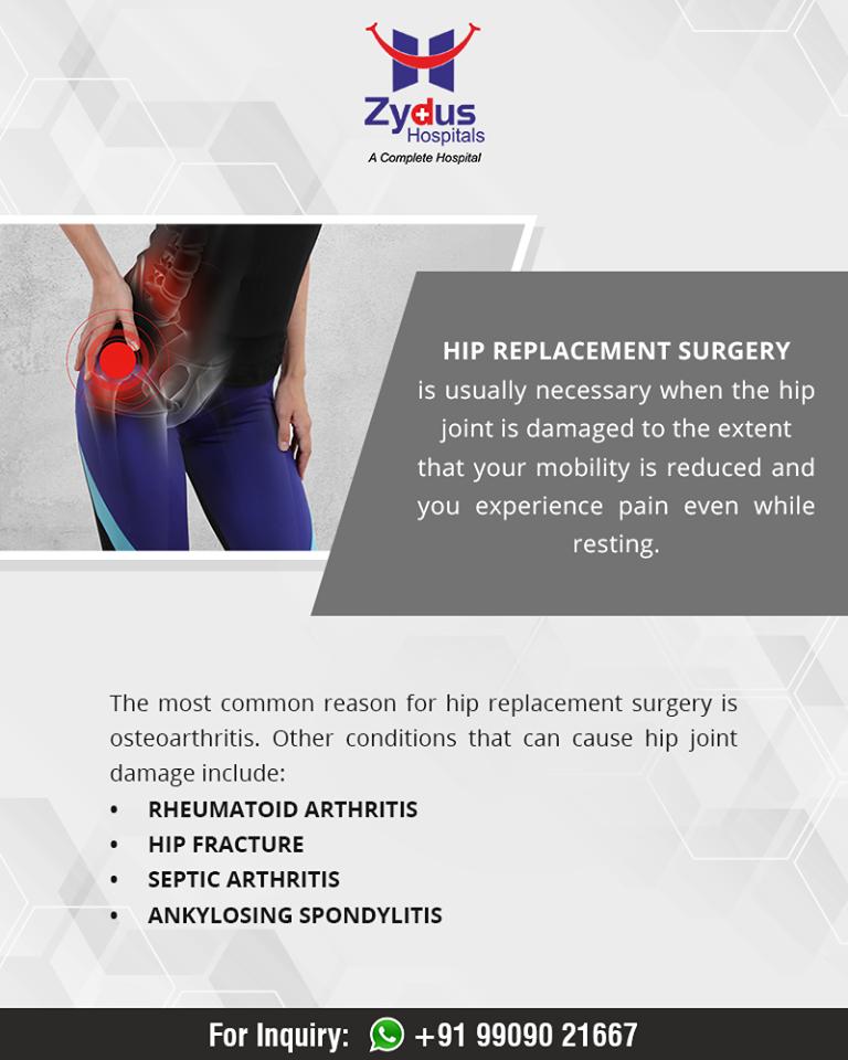 Reasons that can cause hip joint damage

#HipReplacement #HumanHip #ZydusHospitals #Ahmedabad #GoodHealth #WeCare https://t.co/NbIlxWjTPE