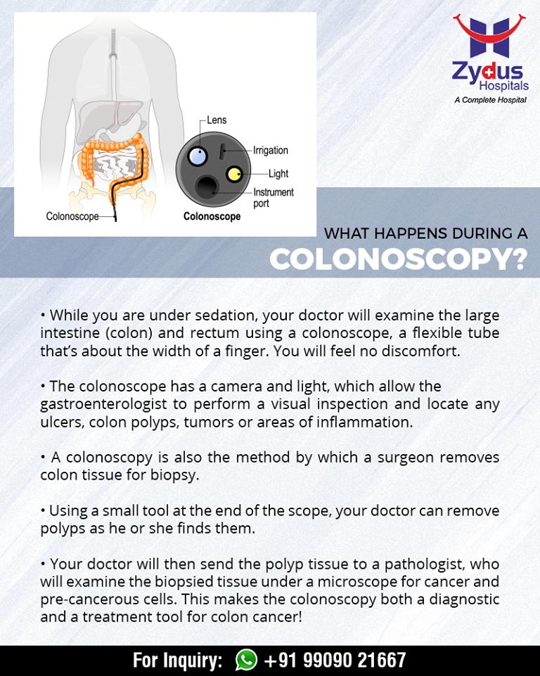 Exactly what happens while you undergo a #colonoscopy! 

#ZydusHospitals #StayHealthy #Ahmedabad #GoodHealth #ZydusCares #DidYouKnow https://t.co/gKv9SkLJPx