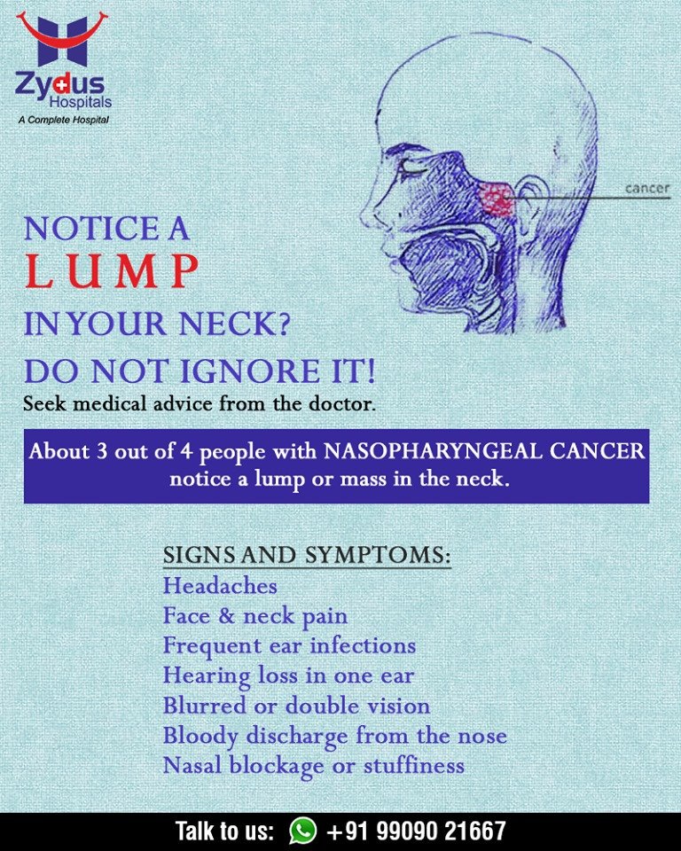 Seek medical advice for the lump in your neck it can be a symptom of nasopharyngeal cancer!

#Symptom #NasopharyngealCancer #ZydusHospitals #Recruitment #Ahmedabad #Gujarat https://t.co/gHV5JmlQ7l