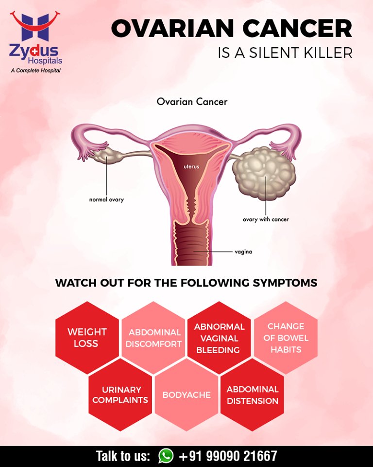 Ovarian cancer is a silent killer.

#OvarianCancer #ChangeIsGood #CancerCentre #ZydusHospitalCancerCentre #CancerCare #ZydusCare #ZydusHospitals #Ahmedabad #Gujarat https://t.co/803v31lk8R