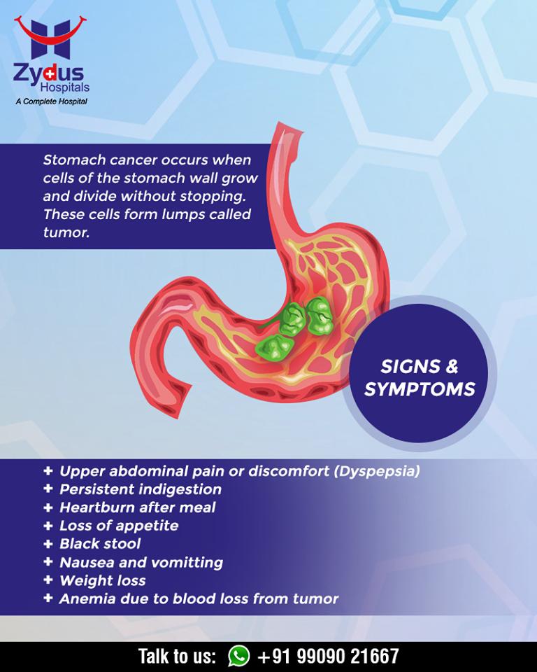 Sign and symptoms of stomach cancer!

#ChangeIsGood #CancerCentre #ZydusHospitalCancerCentre #CancerCare #ZydusCare #ZydusHospitals #Ahmedabad #Gujarat https://t.co/jBA6bOp3L1