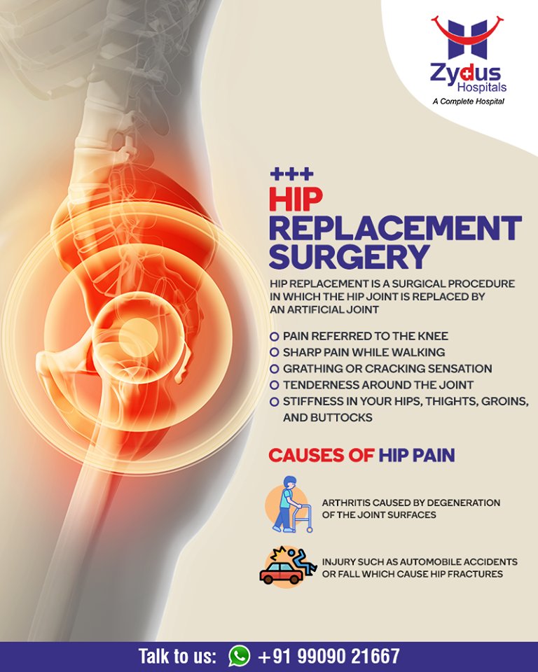 Hip replacement is a surgical procedure in which the hip joint is replaced by an artificial joint. 
ReadMore:https://t.co/5zrb27o2Qh

#Hipreplacement #JointPain #jointreplacement #truealigntechnique #HipJointReplacement #StayHealthy #ZydusCare #ZydusHospitals #Ahmedabad #Gujarat https://t.co/fqNv4TOOyD