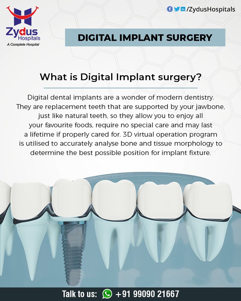 Digital dental implants are a wonder of modern dentistry. They are replacement teeth that are supported by your 
ReadMore:https://t.co/zalPhRtnmo

#dental #dentist #dentistry #smile  #dentalcare #dentalclinic #teethstraighten #ZydusHospitals #HealthCare #ZydusCare #Ahmedabad https://t.co/xZQo0aRwcw
