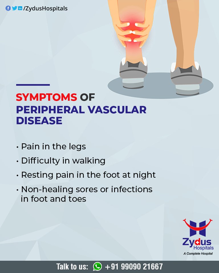 Peripheral vascular disease is a sign of fatty deposits and calcium building up in the walls of the arteries (atherosclerosis).

#PeripheralVascularDisease #ZydusHospitals #HealthCare #ZydusCare #Ahmedabad https://t.co/hwZa3P94a0